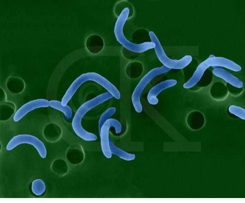 螺旋体中不乏许多与人类密切相关的成员,比如苍白密螺旋体就是导致